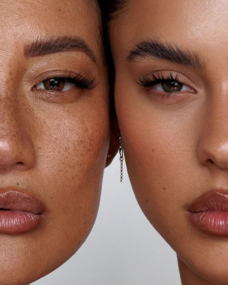 Client with natural, glowing skin
